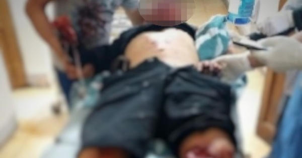 Nghi án nổ mìn tự chế, một người đàn ông nhập viện nguy kịch trong đêm giao thừa