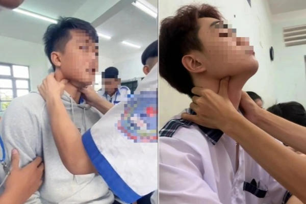 CDC Hà Nội cảnh báo trào lưu 'bắt pen' ở giới trẻ