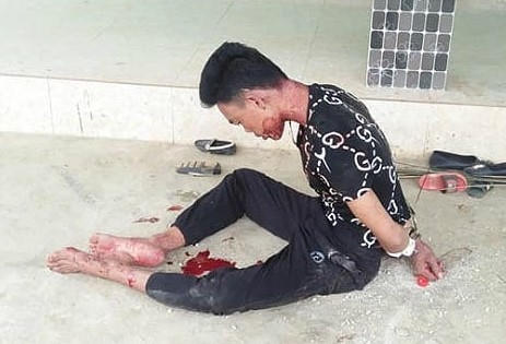 Nghi án chồng sát hại vợ rồi tự cứa vào cổ tự vẫn?