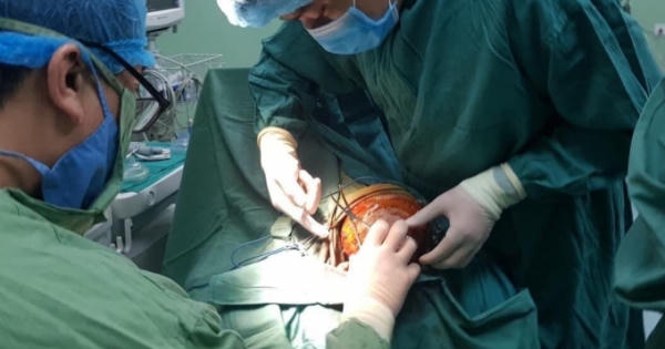 Cháu bé 5 tuổi bị chó nhà cắn toác nửa da đầu, lộ cả xương sọ