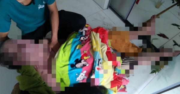 TP HCM: Người đàn ông bị bỏng nặng dẫn đến tử vong sau khi xông hơi tại phòng khám Đông y