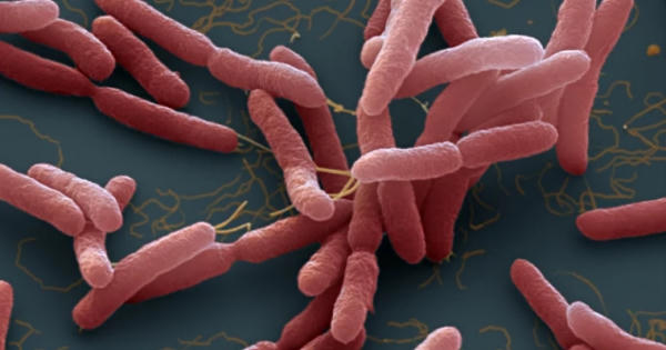 Quảng Nam ghi nhận một bệnh nhân tử vong do "vi khuẩn ăn thịt người"