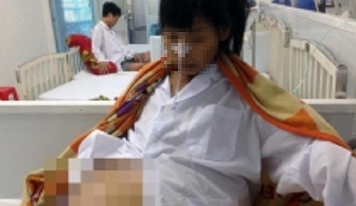 Chớ để nang buồng trứng thành “trứng khủng long”