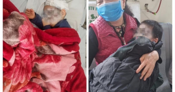 Lào Cai: Ba bố con bị chó dữ tấn công gây thương tích