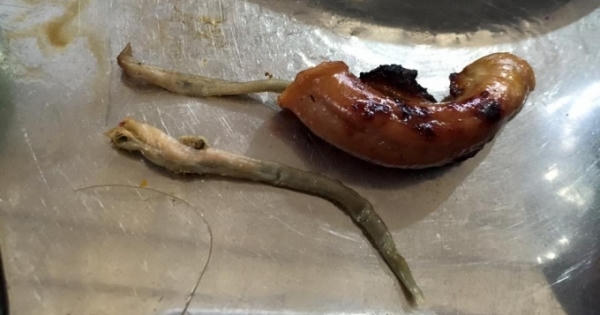 Vụ giun sán sót trong lòng lợn tại quán nướng chỉ là... giọt nước tràn ly? Vụ giun sán sót trong lòng lợn tại quán nướng chỉ là... giọt nước tràn ly?