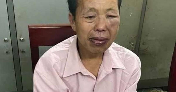 “Ông trùm” ma túy dùng súng, dao chống trả quyết liệt khiến 1 trinh sát bị thương