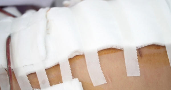 TP HCM: Lập tổ công tác xác minh vụ bệnh nhân thủng bụng sau khi hút mỡ