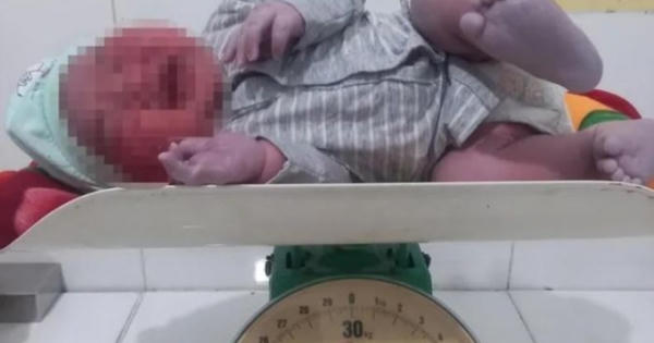 Bé trai chào đời nặng 6kg ở Hà Tĩnh Bé trai chào đời nặng 6kg ở Hà Tĩnh