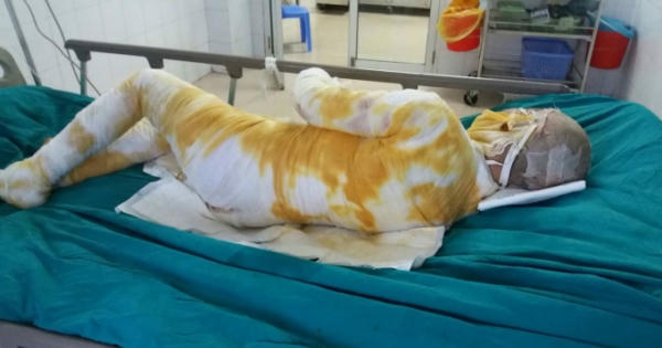 Diễn biến mới nhất vụ tẩm xăng đốt bạn gái do ghen tuông ở Vĩnh Phúc