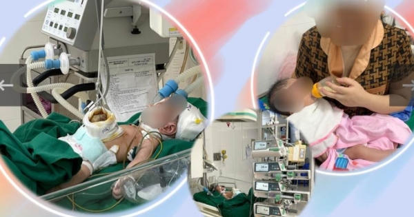 Cứu sống trẻ sơ sinh bị dị tật bẩm sinh Omphalocele hiếm gặp
