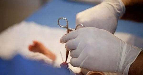 Cắt bao quy đầu tại phòng khám tư, trai trẻ suýt mất "của quý"