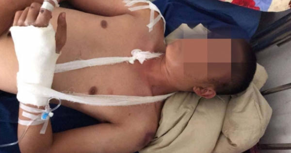Đi đòi nợ, nam thanh niên bị chém nhập viện