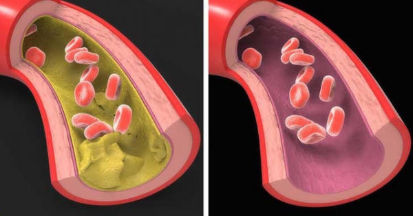 Cơ thể bạn sẽ ra sao khi uống dầu cá hàng ngày?