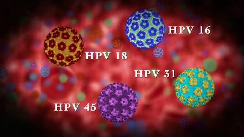 Hàng nghìn người Mỹ đứng ngồi không yên vì trót tiêm vắc xin HPV Hàng nghìn người Mỹ đứng ngồi không yên vì trót tiêm vắc xin HPV