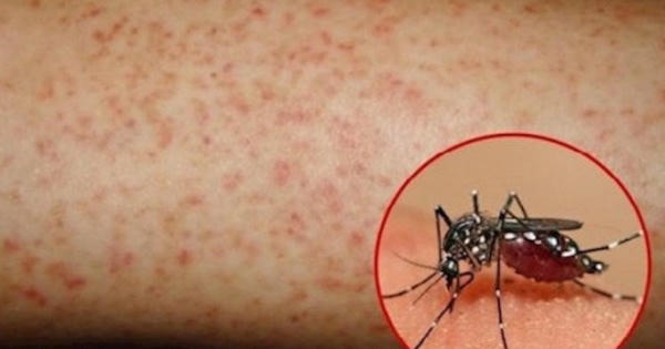 Tăng cường các biện pháp phòng chống dịch bệnh sốt xuất huyết Tăng cường các biện pháp phòng chống dịch bệnh sốt xuất huyết