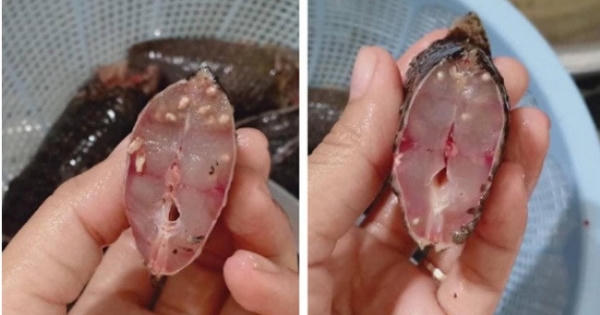 "Hé lộ" sự thật về căn bệnh ấu trùng sán!