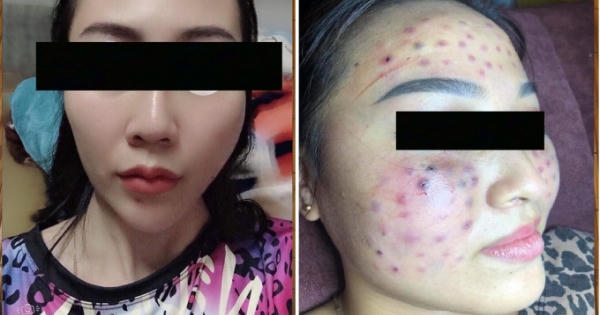 Vụ spa "cỏ" tại Hà Nội: Phòng y tế quận Cầu Giấy nói gì?