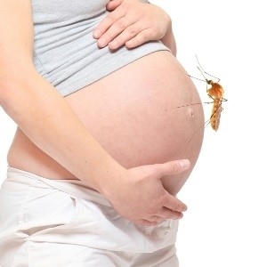 Một thai phụ nhiễm Zika sinh con không bị tật đầu nhỏ