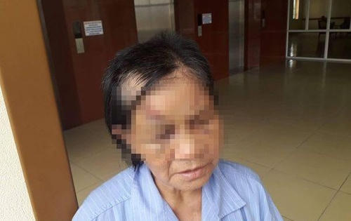 Phẫn nộ với người cháu ngoại trói tay, bịt miệng, đánh bà gãy 5 xương sườn