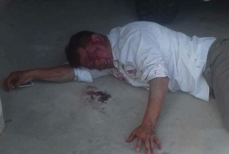 Chủ thầu xây dựng bị cha con giám đốc đánh nhập viện?