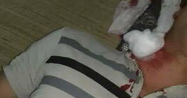 Hòa Bình: Đang nằm xem điện thoại trong nhà, một người nghi bị đạn rơi trúng cổ