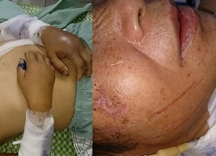 Phú Thọ: Phẫn nộ nam thanh niên đánh hàng xóm bất tỉnh