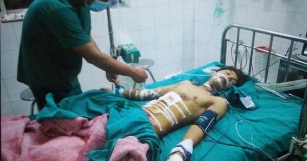 Thủng bụng, cụt tay vì đèn pin Trung Quốc phát nổ