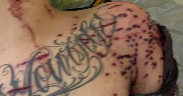 Thái Bình: Nổ súng tại trạm BOT, một nam thanh niên ngã gục tại chỗ