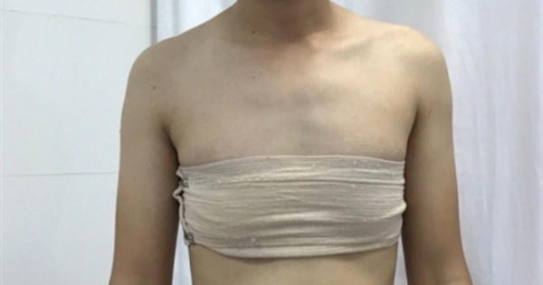 Bộ Y tế đề xuất người độc thân 18 tuổi trở lên mới được phép chuyển giới