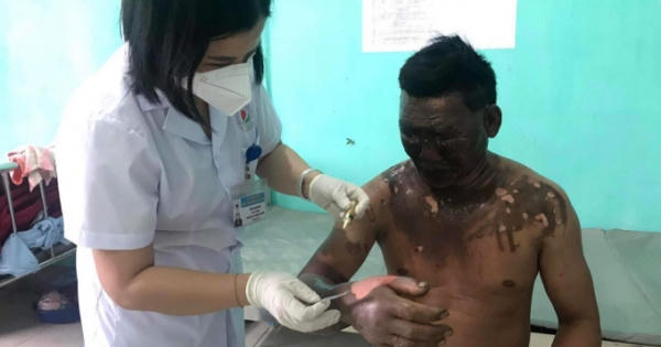 Hà Giang: Nổ bình gas mini trong khi ăn lẩu, một người nhập viện