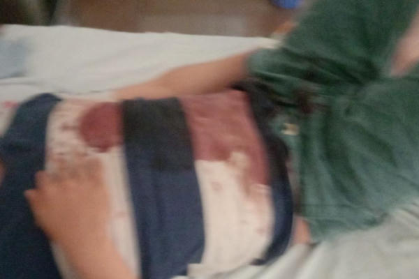 Hà Nội: Một người đàn ông bị nhóm người lạ đâm trọng thương tại khu trọ