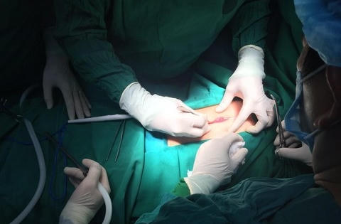 Có "bệnh" thích ăn tóc từ nhỏ, bé gái ăn hơn nửa cân tóc vào bụng