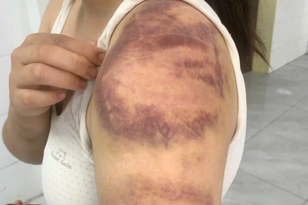 Tạm giữ người đàn ông ở Bắc Ninh bạo hành vợ con suốt 4 ngày