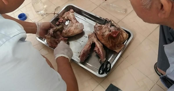 Bệnh sán dây lợn: Nguy cơ mắc phải nhiều bệnh nếu nuốt phải trứng, nang ấu trùng