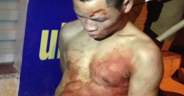 Hà Nội: Nam thanh niên đâm thủng cổ tài xế taxi trong đêm