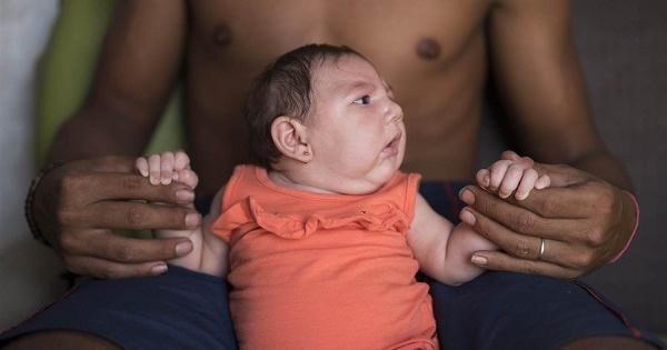 Virus Zika gây chứng đầu nhỏ và biến chứng về não ở trẻ Virus Zika gây chứng đầu nhỏ và biến chứng về não ở trẻ