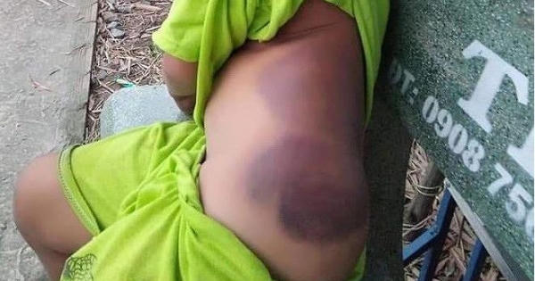 Phụ huynh cả nể 'đồng lõa' với bạo hành học đường