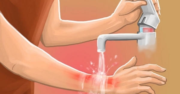 Để giảm thiểu tai nạn bỏng nước sôi ở trẻ em