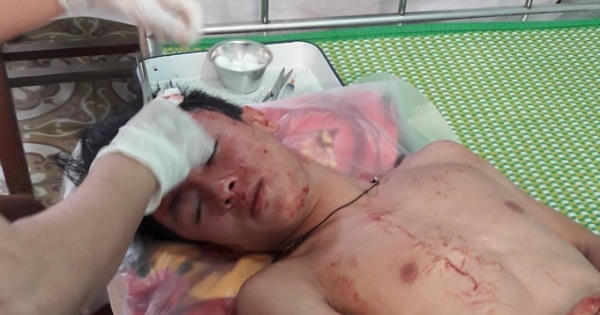 Sở GD&ĐT Nghệ An chỉ đạo làm rõ vụ thầy và trò bị nhóm côn đồ đánh nhập viện