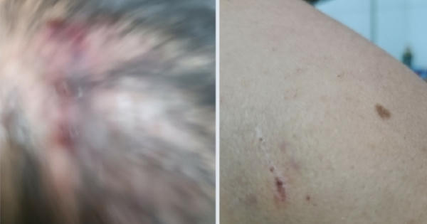 Quảng Ninh: Bị xâm phạm chỗ ở, công dân còn bị hành hung gây thương tích Quảng Ninh: Bị xâm phạm chỗ ở, công dân còn bị hành hung gây thương tích