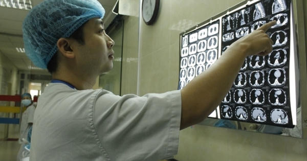 Suýt thủng thực quản vì hóc xương gà chữa “mẹo”