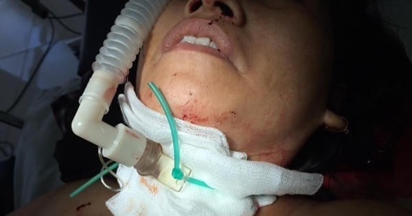 Chủ tiệm tóc bị kẻ lạ mặt xông vào cứa cổ: Có dấu hiệu hiếp dâm