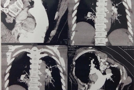 Bỗng dưng mất ý thức đột ngột, hãy đến bệnh viện ngay