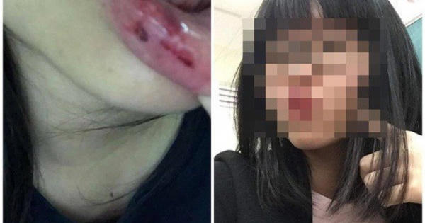 Vụ MC bị tố bạo hành: 'Nữ sinh 15 tuổi đang gặp vấn đề nghiêm trọng'