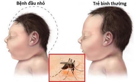 Việt Nam có quần thể muỗi Zika tồn tại ngoài tự nhiên