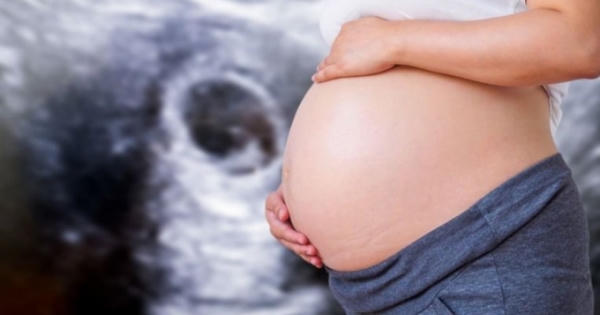 Thất kinh vì con chào đời không mặt, mắt, mũi, cha mẹ kiện bác sĩ sản