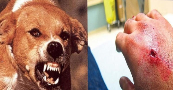 Cụ bà tử vong vì lên cơn dại sau khi bị chó hàng xóm cắn