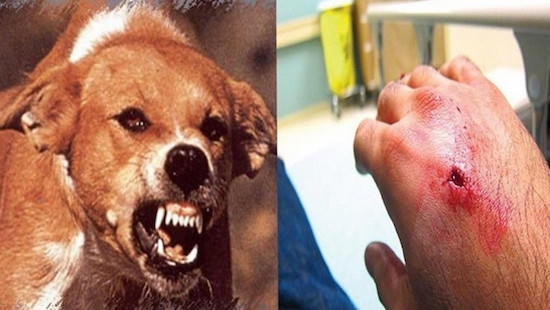 67 người chết vì chó dại cắn trong 9 tháng đầu năm 67 người chết vì chó dại cắn trong 9 tháng đầu năm