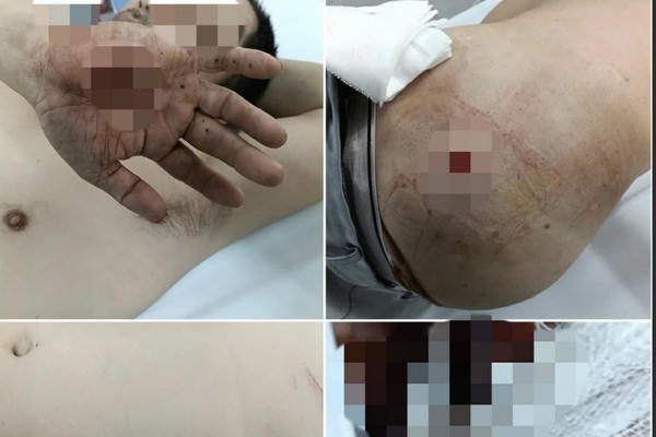 Vụ xô xát bằng hung khí tại Cửa khẩu Quốc tế Cha Lo, hé lộ mâu thuẫn cá nhân kéo dài trước đó