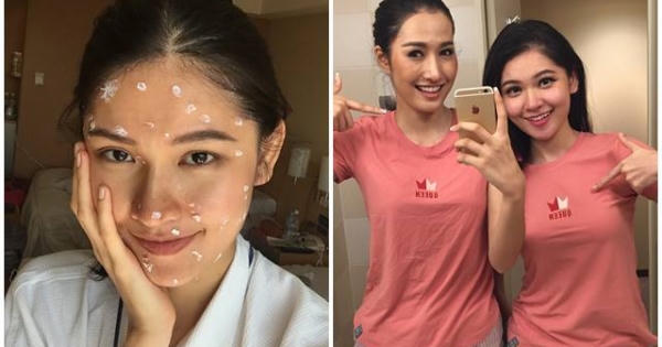 Thùy Dung bất ngờ bị bệnh thuỷ đậu trước thềm chung kết Miss International